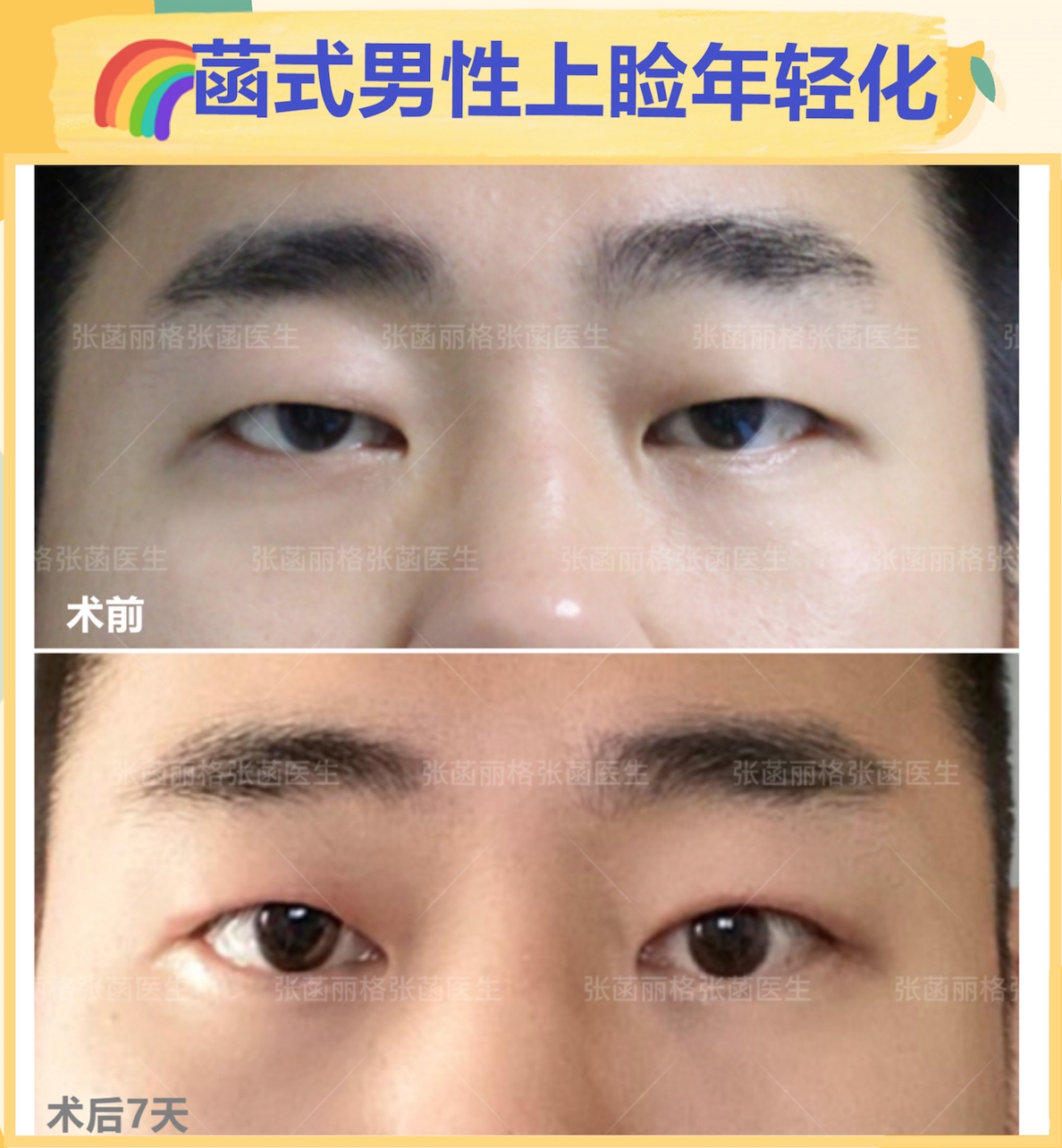 直播预告｜开启健康新「享」法，解锁“四维健康”的行动指南